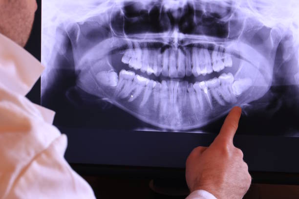 Best Emergency Gum Pain Relief  in St Paul, MO